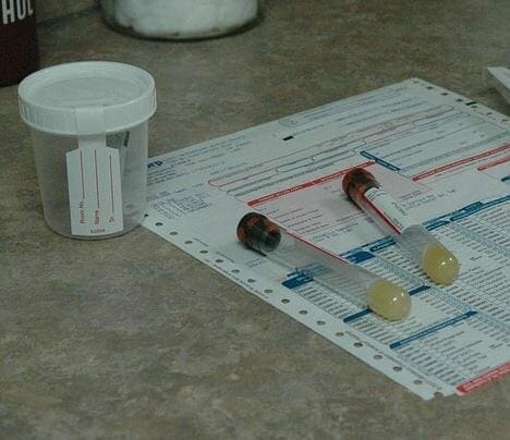 drug test