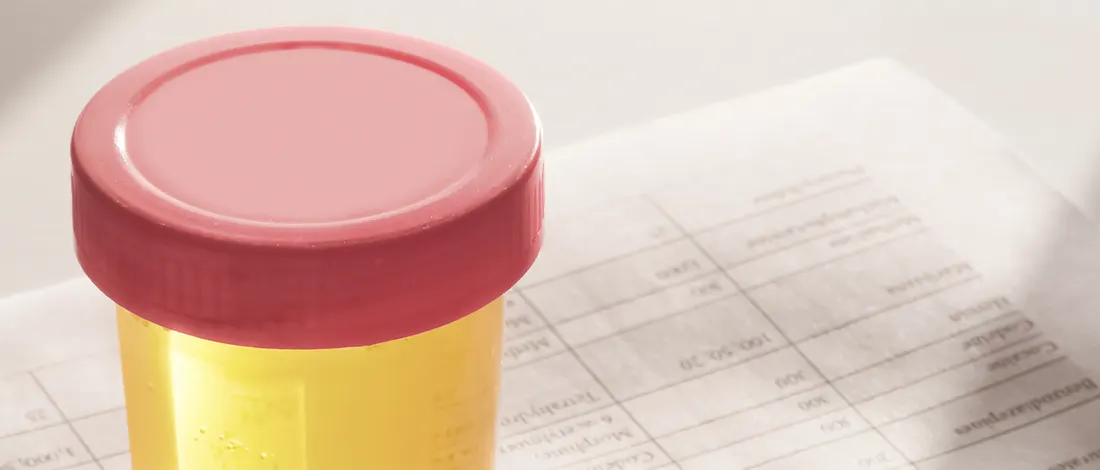 Urine plastic container 